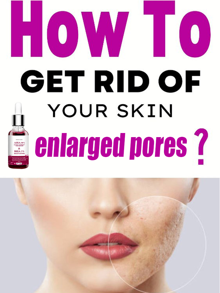 Salicylic Acid Blackhead Remover - Serum zwężające pory z kwasem salicylowym